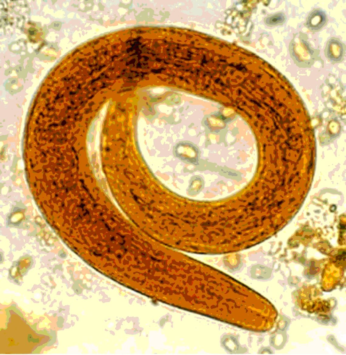 strongyloides-ratti-igg-milenia-biotec