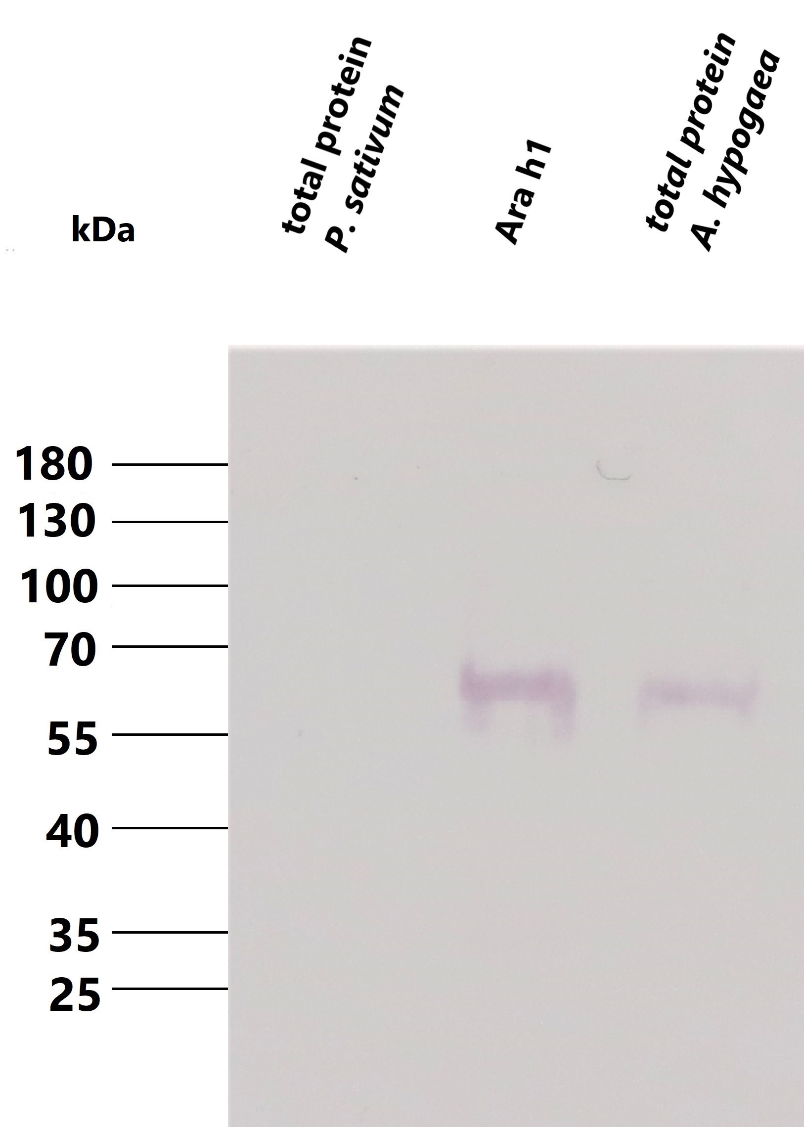 Nogen Disco Framework Ara h1 Antibody (20D3) - Milenia Biotec