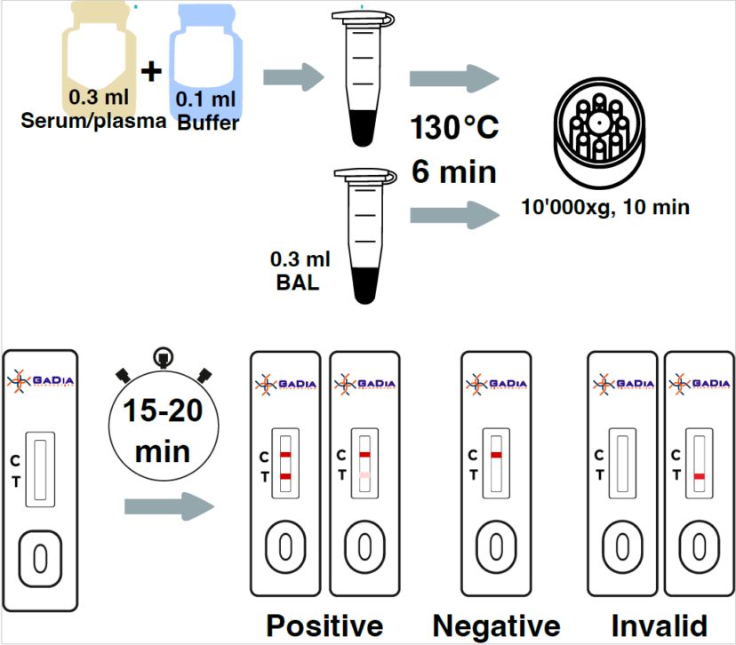 Aspergillus Antigen (Galactomannan) - Rapid Test - Milenia Biotec